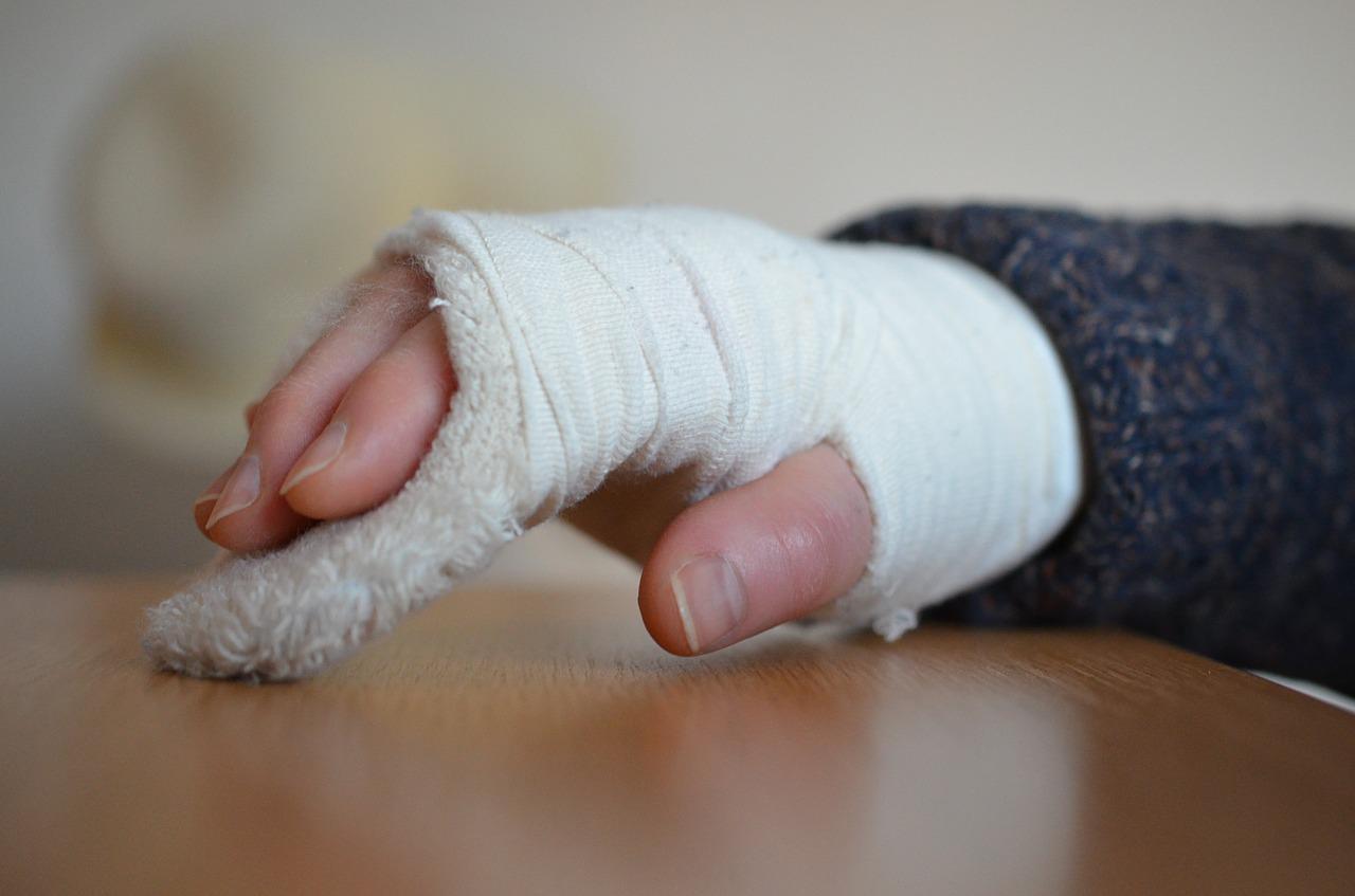 Leczenie zapalenia stawów rąk i wskazówki – jak je wyleczyć