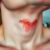 Co to jest angina? Objawy, przyczyny i skuteczne leczenie
